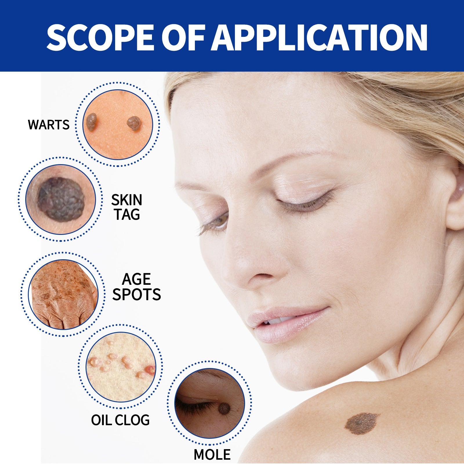 ke Wart Essence, Repair Moles, Flesh Granules, Flatness, Especially Clear Skin Body Skin Care