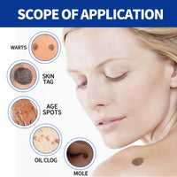 ke Wart Essence, Repair Moles, Flesh Granules, Flatness, Especially Clear Skin Body Skin Care
