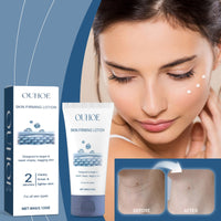 Ouhoe Skin Firming And Moisturizing Lotion, Lightening Fine Lines, Moisturizing, Whitening, Moisturizing And Moisturizing Body Lotion