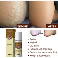 Herbal foot soothing spray