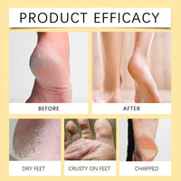 Coconut Foot Cream, Natural Coconut Foot Cream Moisturizes And Restores Dry And Cracked Skin