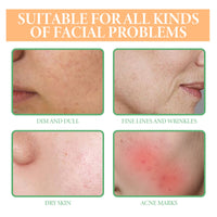 Turmeric Oil, Reduce Wrinkles Acne Silent Dark Moist Brightens The Firming Skin