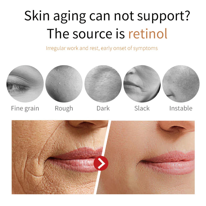 Collagen Essence Lightens Fine Lines, Tightens Pores Around Eyes, Moisturizes And Moisturizes Skin