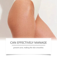 West&Month Butt Acne Treatment Shower Gel, Body Skin Clean And Fade Acne Mild And Refreshing