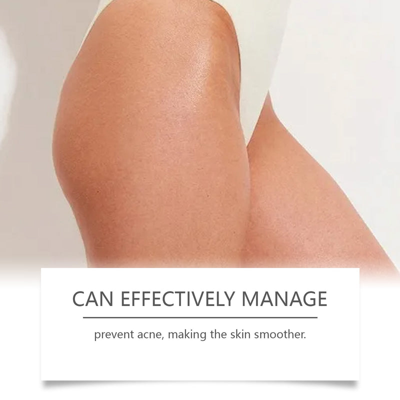 West&Month Butt Acne Treatment Shower Gel, Body Skin Clean And Fade Acne Mild And Refreshing