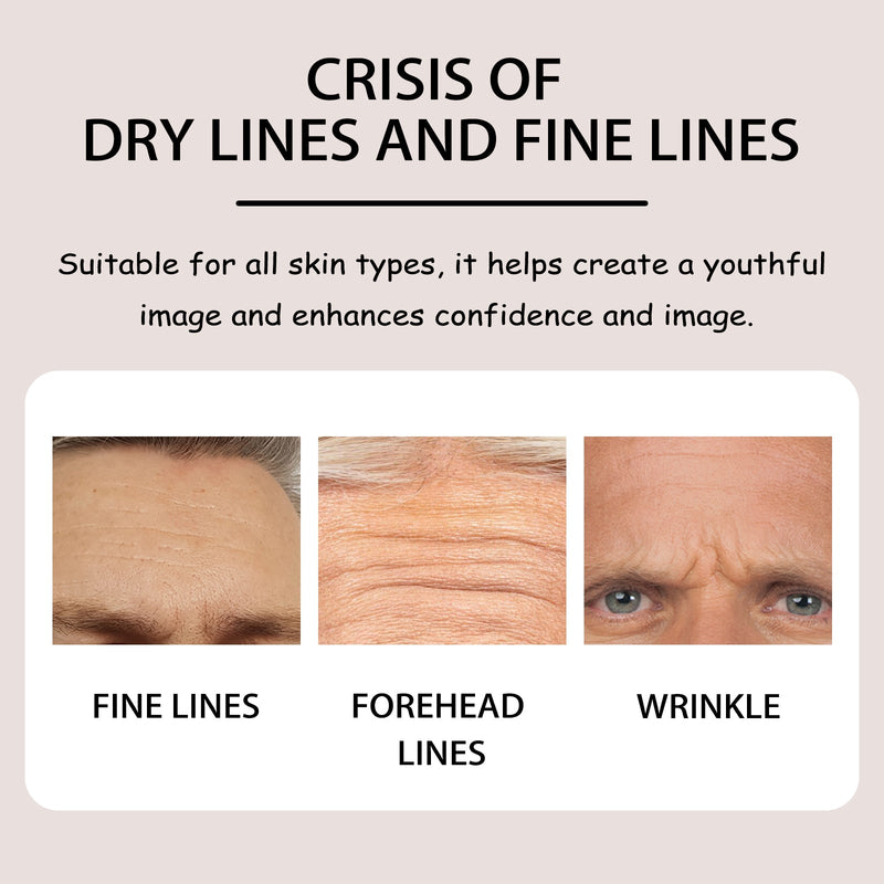 Forehead Mask, Lighten And Smooth Fine Lines And Wrinkles, Lift And Tighten Facial Skin
