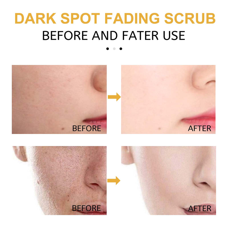 Turmeric Exfoliating Facial Scrub For Deep Cleansing Of Delicate Pores And Beauty Cleansing Treatment