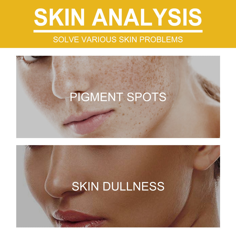 V7 Whitening Cream Reduces Wrinkles And Fine Lines On The Face, Moisturizes And Brightens Skin, Anti-Aging And Replenishing Cream