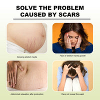 Tummy Tucking Cream, Moisturizing And Smoothing Skin Repair Cream For Surgical Scars And Pregnancy Wounds