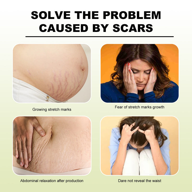 Tummy Tucking Cream, Moisturizing And Smoothing Skin Repair Cream For Surgical Scars And Pregnancy Wounds