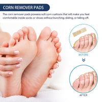 South Moon Gram Warty Corns Patch, Foot Soles Chicken Especially Clean Flesh Piercing Wart Wart Repair Patch Plain Sweat Tube Repair Patch