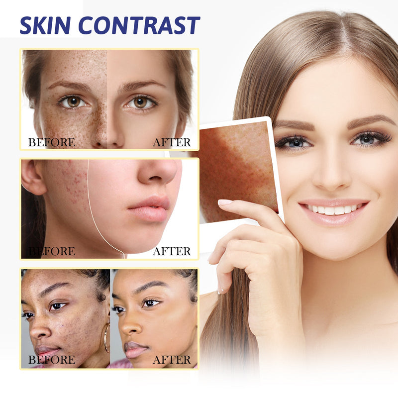 Brightening Cream, Lightening Dark Spots, Spot Repair Rough, Brightening Complexion And Improving Dullness Beauty Cream
