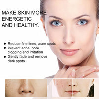 EELHOE Skin Care Cream Improves Dull Skin, Moisturizes Skin, Brightened Skin Care Cream And Clears Acne