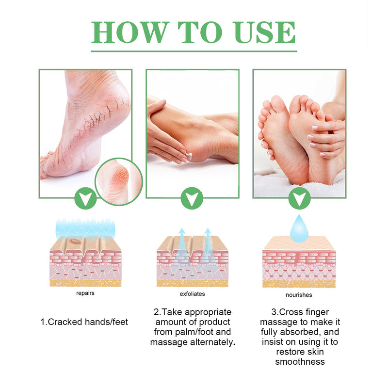 Dry Crack Protection Moisturizing Cream, Moisturizing And Hydrating Hand And Foot Repair Skin Care Cream