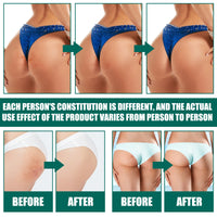Butt Cream, Moisturizing Lighten Acne Mark Fresh Skin Moisturizing Mild Repair Acne Cream