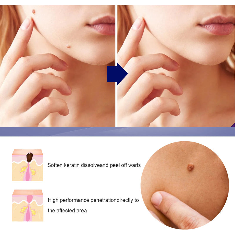 OUHOE Skin Care Cream Moisturizing Body Skin Label Gentle Moisturizing Clean Smooth Kayo Care Cream