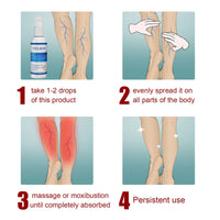EELHOE Intravenous Massage Spray For Varicose Veins Relief And Earthworm Leg Blood Vessel Bulge Pain Spray