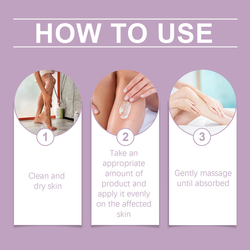 Varicose Veins Cream, Helps Relieve Leg Tightness And Improve Comfort