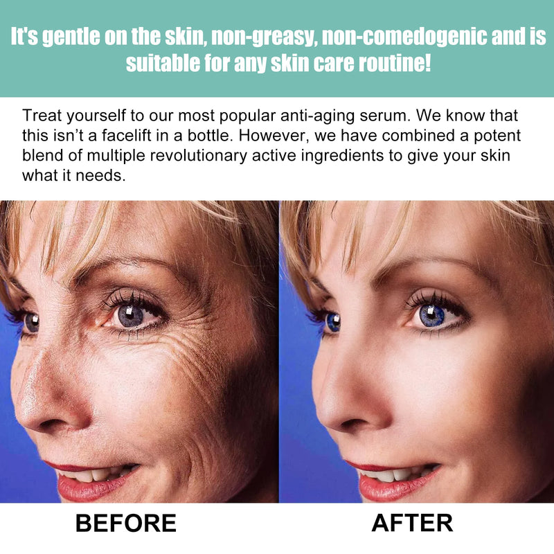 Anti-Wrinkle Serum, Improve Skin Fine Lines Crow 's-Feet Hydrating Moisturizing Anti-Wrinkle Ease Aging Essence