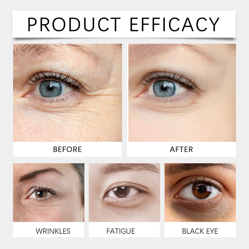 Eye Cream For Eyebags, Mild Skin Lotion To Reduce Puffy And Dark Circles Under The Eyes