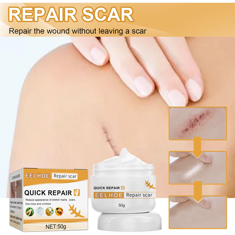 EELHOE Desalting Skin Scar Cream, Skin Burn Scalding Surgical Scar Wound Repair Cream