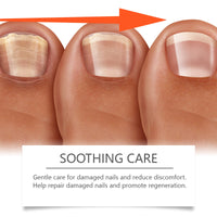 Herbal Nail Care Solution Hand, Foot And Nail Cleansing And Repair Bright Nail Thick Toe Care Solution