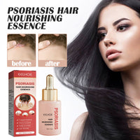 Moss Hair Nourishing Essence, Deep Cleaning Scalp, Anti-Dandruff And Itchy Refreshing Hair Care Solution