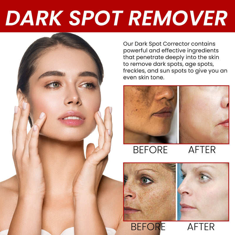 OUHOE Dark Spot Removal Cream, Moisturizing Repair Lighten Face Fine Lines And Spots Skin Whitening Cream