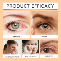 Jimerito Honey For Eyes, Refreshing, Moisturizing And Soothing Eye Drops For Dry And Astringent Eyes