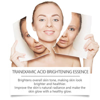 West&Month Brightening Essence, Even, Bright, Refreshing, Non-Sticky, Natural, Shiny And Nourishing Skin Essence