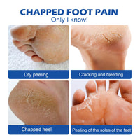 Hand And Foot Moisturizing Cream, Moisturizing And Moisturizing Body Moisturizer