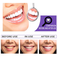 EELHOE Teeth Whitening Toothpaste, Removing Teeth Stains And Odors Oral Care Brightening And Whitening Teeth Toothpaste