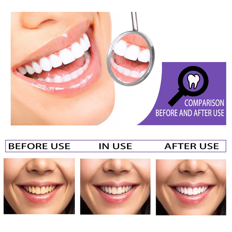 EELHOE Teeth Whitening Toothpaste, Removing Teeth Stains And Odors Oral Care Brightening And Whitening Teeth Toothpaste
