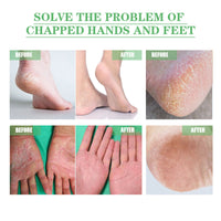 Dry Crack Protection Moisturizing Cream, Moisturizing And Hydrating Hand And Foot Repair Skin Care Cream