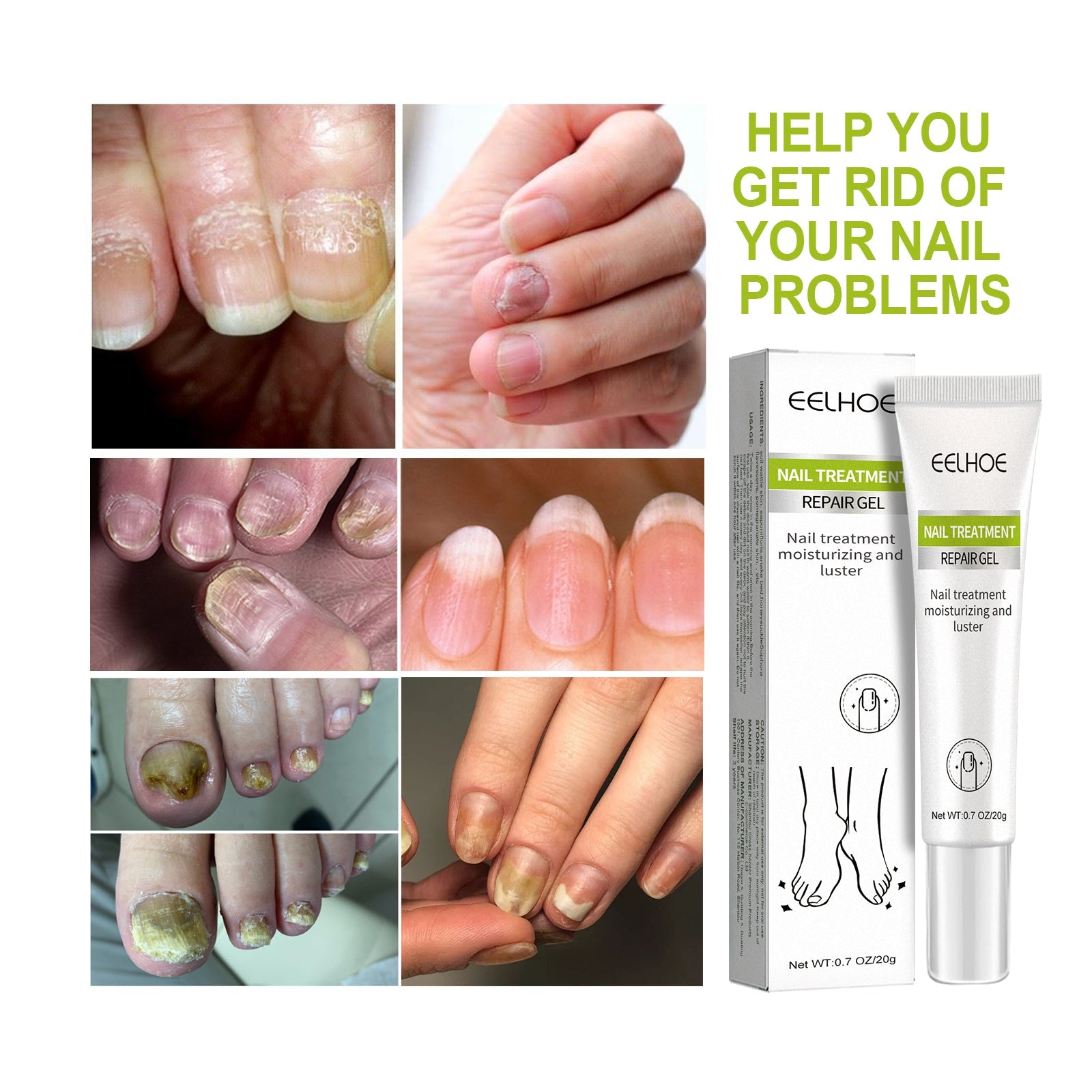 Hand, Foot And Nail Repair, Soft Nail Polish Polish Gel