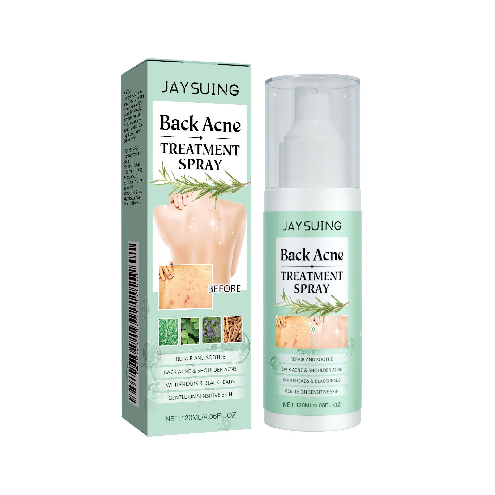 Back Acne Repair Spray, Repair Body Acne Fade Acne Mark Skin Care Spray