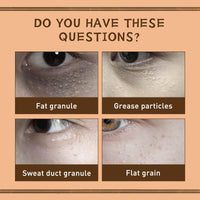 EELHOE Gentian Eye Cream, Improve Eye Fat Granules Firming Fine Line Around Eye Bags Moisture Lock Eye Cream