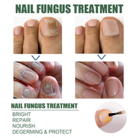 EELHOE Nail Care Liquid (30ml) Gentle Cleaning, Hydrating And Moisturizing Liquid For Thick And Soft Nails On The Surface Of Hands And Feet