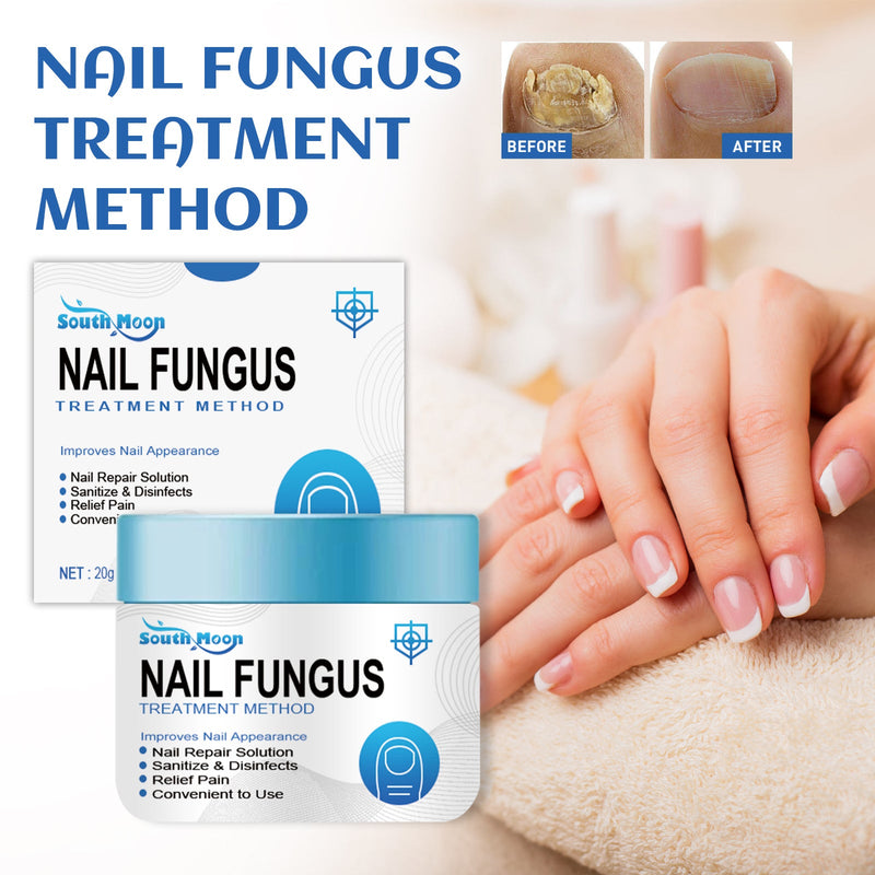 South Moon Nail Fungus Treatment Method, Repair Grey Nail Brightening Nail Thickening Nail Hand And Foot Nails Moisturizing Care Cream