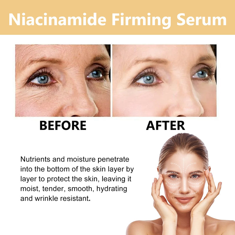 Nicotinamide Firming Serum, Moisturizes And Firming Facial Skin, Brightening Dark Skin Tone Serum