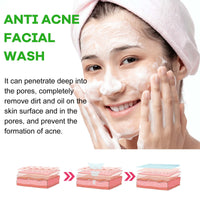 Anti Acne Facial Wash, Deep Clean Oil Dirt Blackhead Acne Shrink Pores Refreshing And Comfortable
