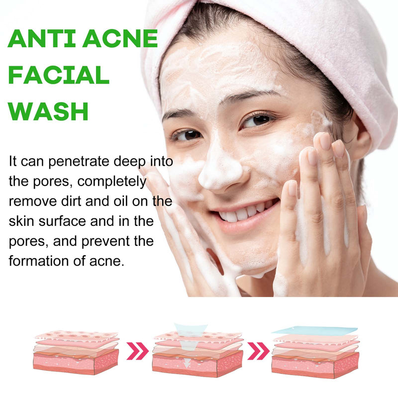 Anti Acne Facial Wash, Deep Clean Oil Dirt Blackhead Acne Shrink Pores Refreshing And Comfortable