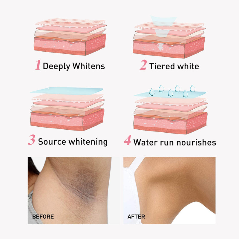 West&Month Niacinamide Intimate Areas Tightening Cream, Fade Dark Skin Even Skin Tone Beauty Skin Whiten Cream