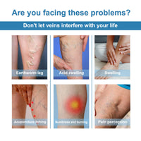 OUHOE Vein Treatment Spray, Relieve Leg Soreness And Swelling Repair Earthworm Leg Vein Treatment Spray