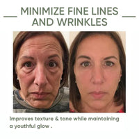 Avocado Anti-Wrinkle Serum, Firming Facial Skin, Anti-Aging, Lightening Fine Lines, Moisturizing Skin Care