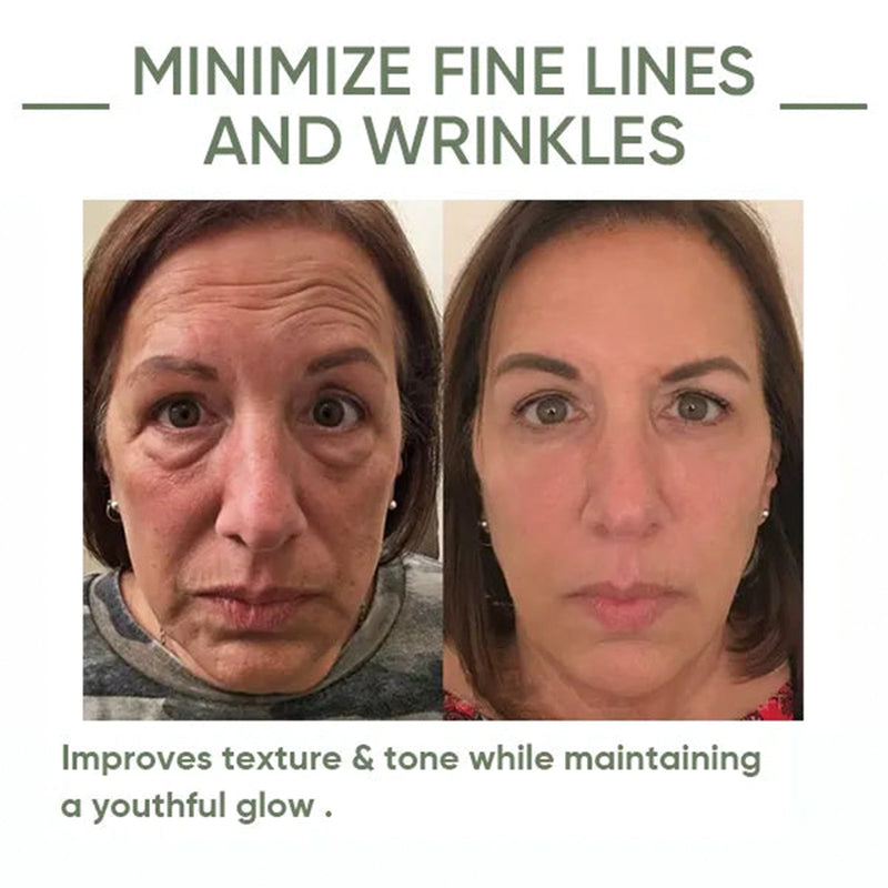 Avocado Anti-Wrinkle Serum, Firming Facial Skin, Anti-Aging, Lightening Fine Lines, Moisturizing Skin Care