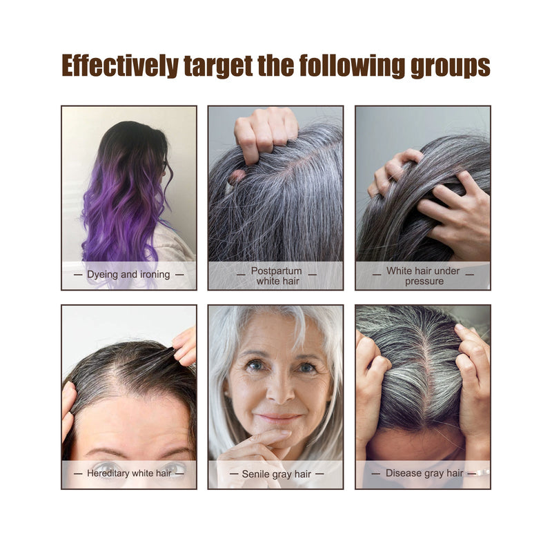 Black Hair Essence Scalp Care Massage Moisturizing Hair And Strengthening Hair Lotion Black Hair Essence