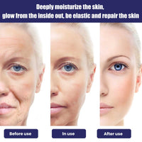 Moisturizing Cream, Reduce Dark Spots And Fine Lines, Moisturize Firm Skin Care Cream