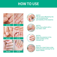OUHOE Nail Care Soft Nail Care Daily Clean Gentle Maintenance Moisturizing Nail Care Solution