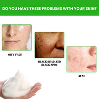Anti Acne Facial Wash, Deep Clean Oil Dirt Blackhead Acne Shrink Pores Refreshing And Comfortable